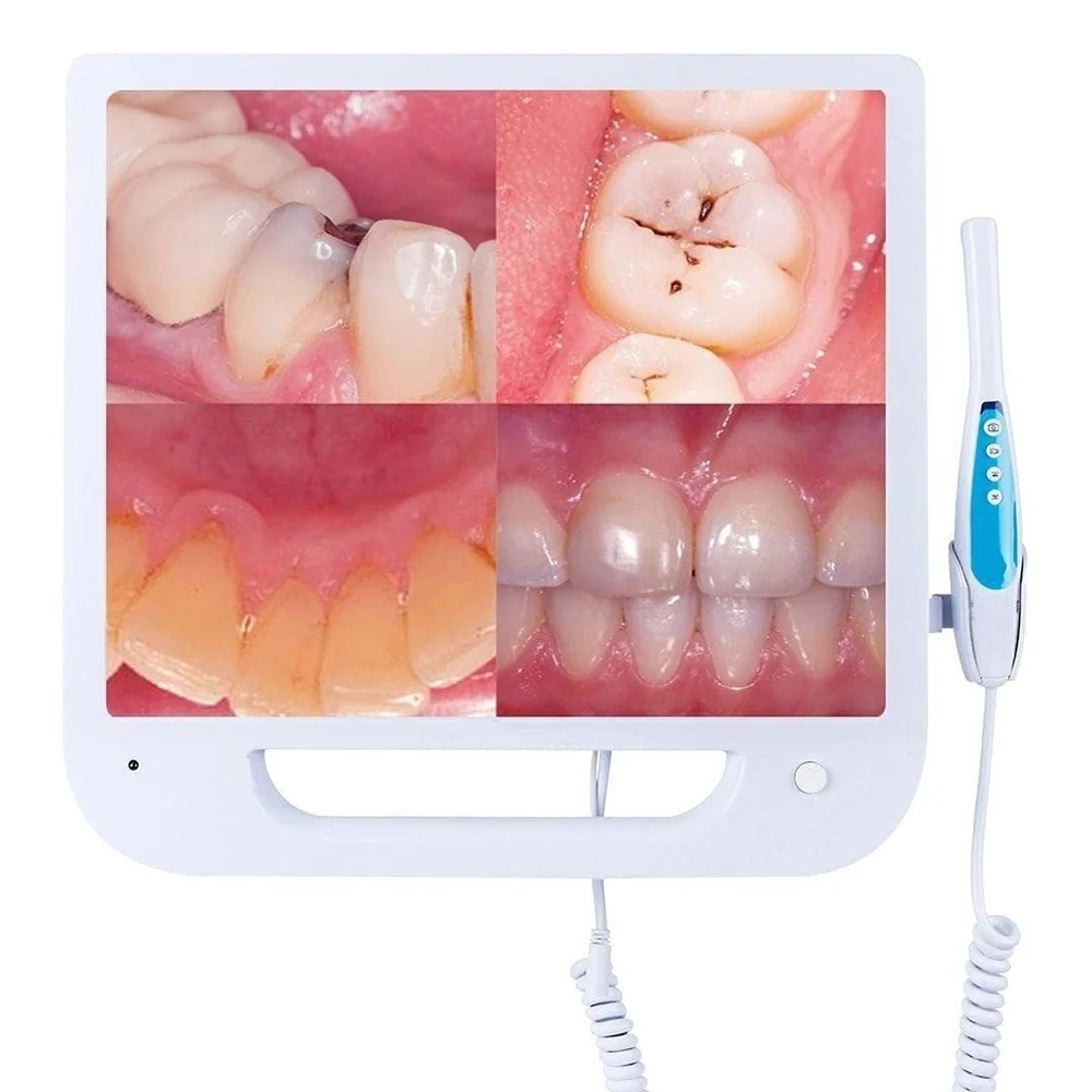 Qualdent Intra Oral Camera With Screen