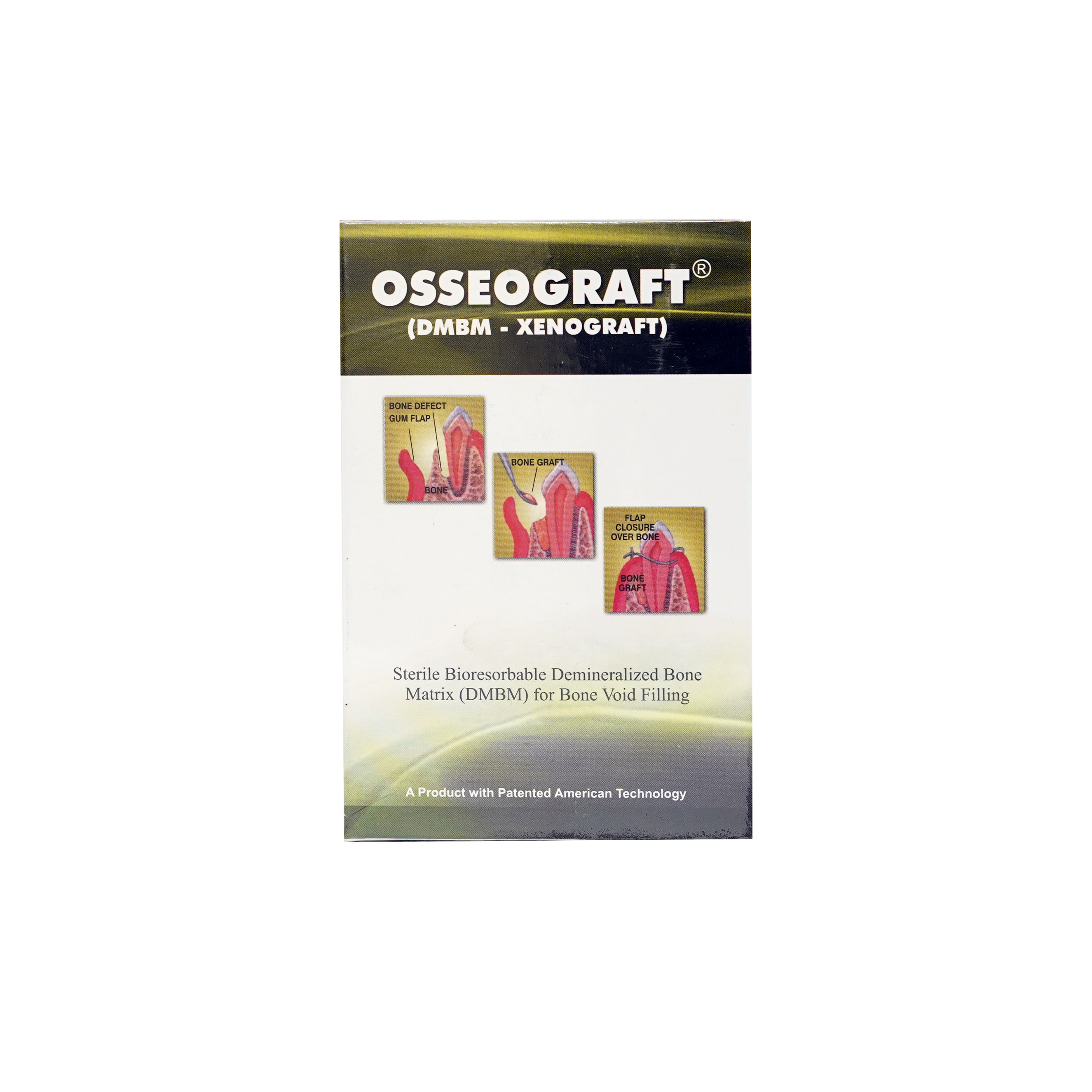 Osseograft