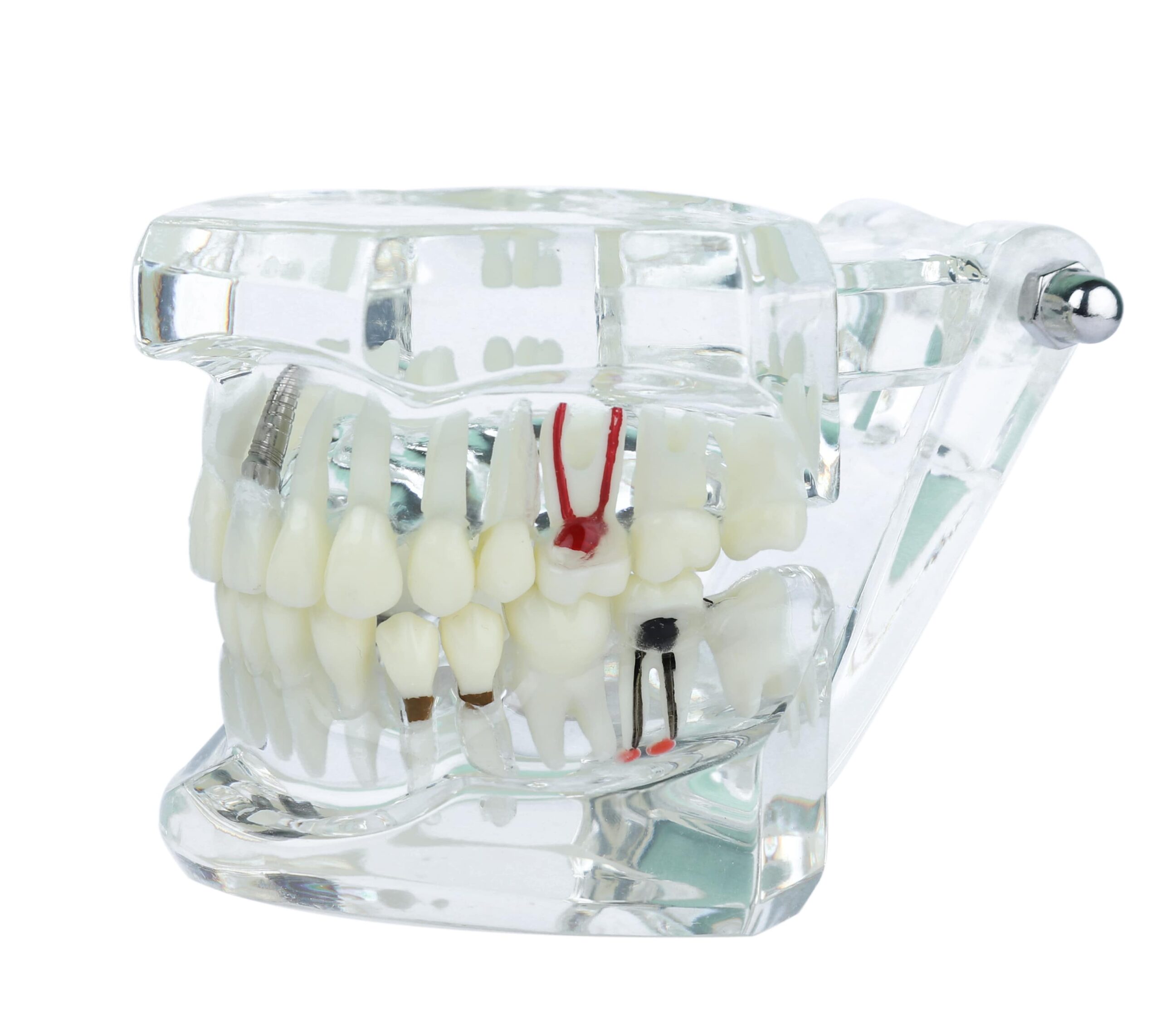 Napple All-in-one implant model