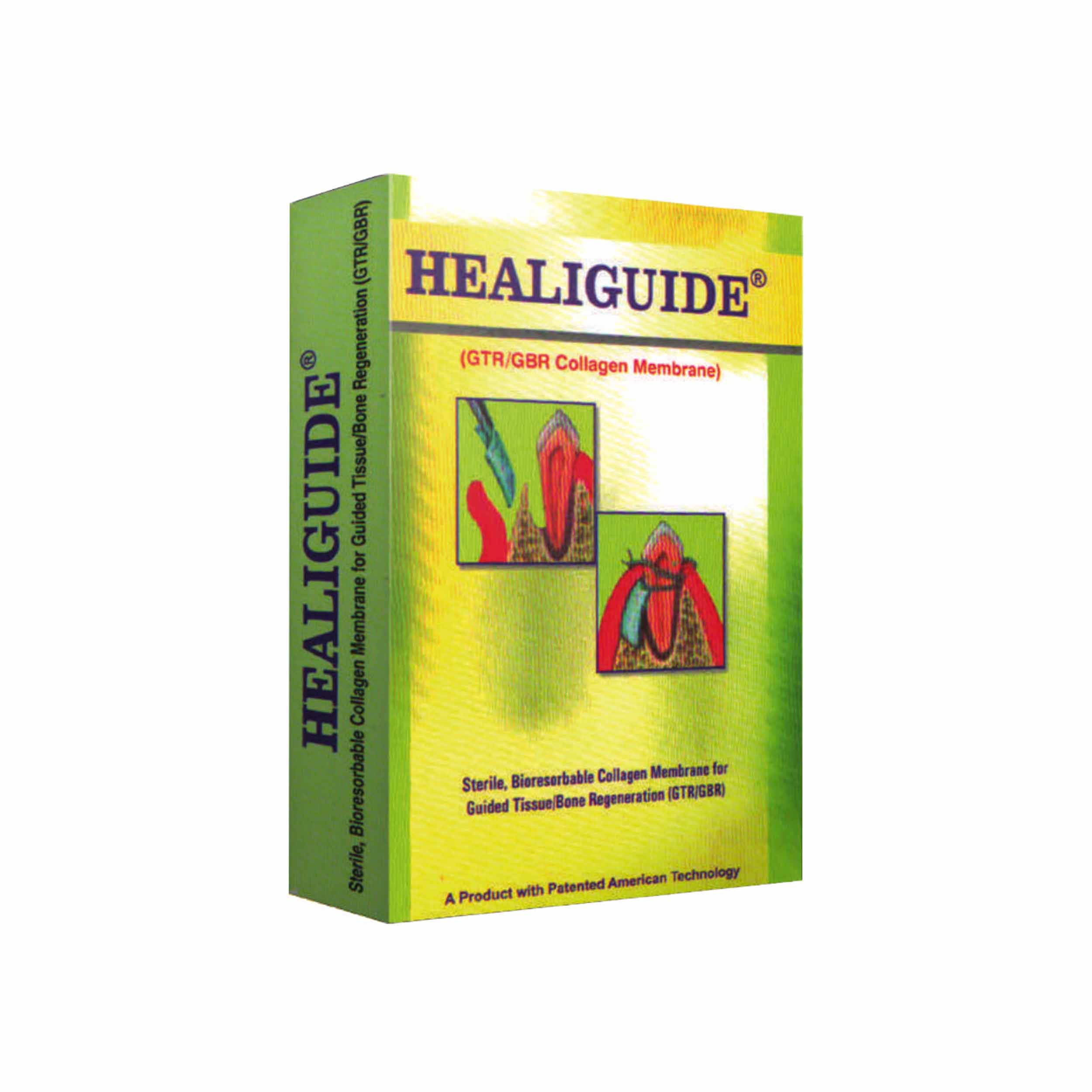 Advance Biotech Healiguide (15x20mm)